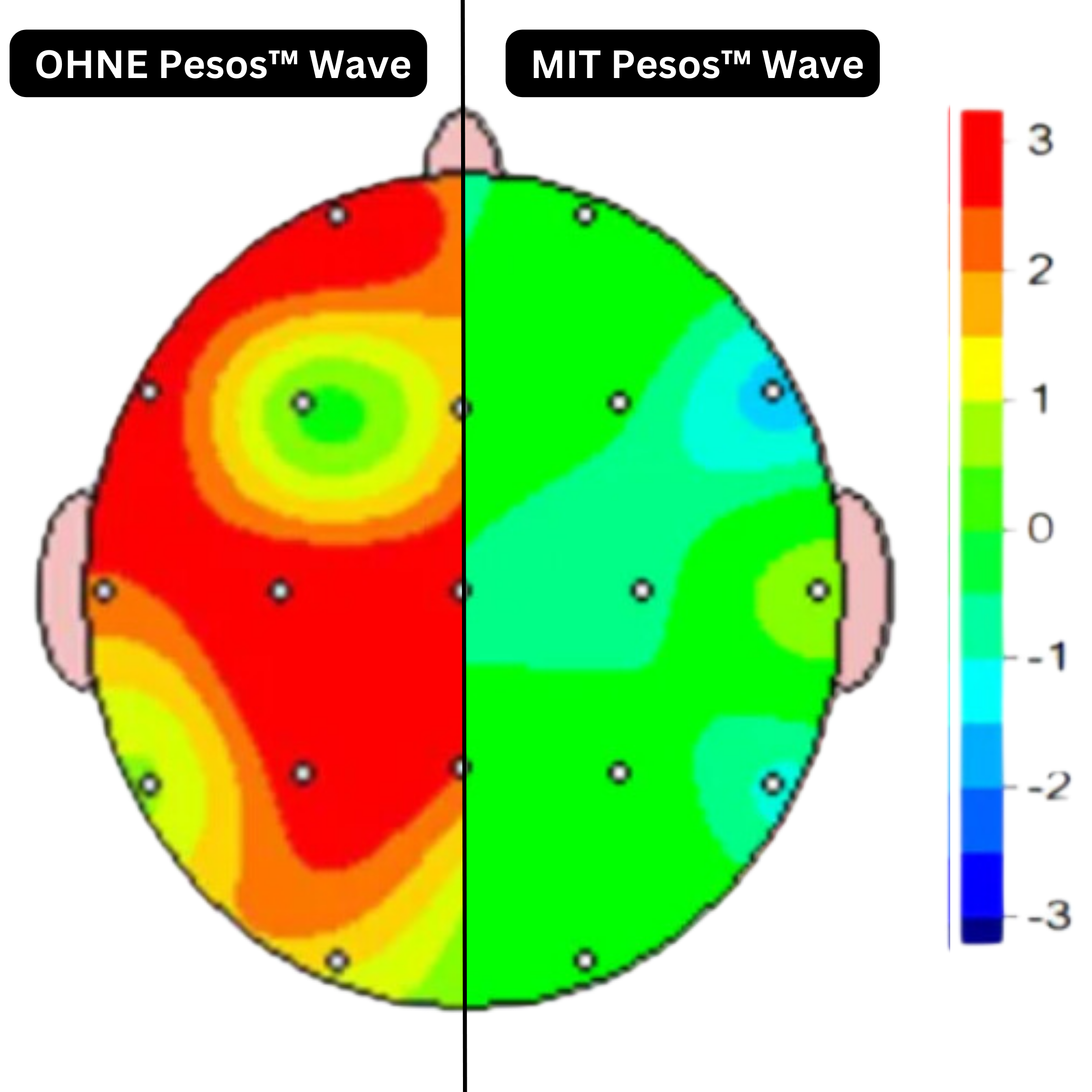 Pesos™ Wave Strahlenschützer